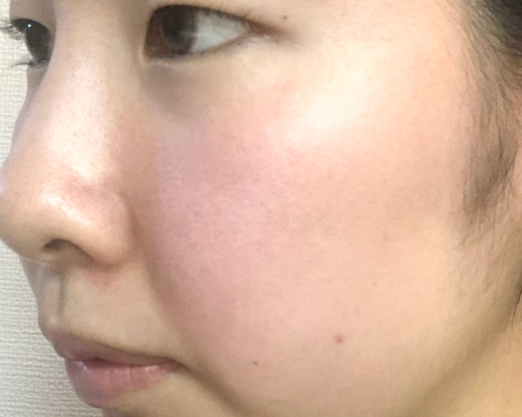 マトリックスエキス　お試し　navis ６日目②